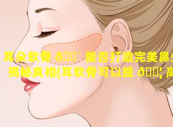 耳朵软骨 🐴 能否打造完美鼻尖揭秘真相(耳软骨可以提 🐦 高鼻尖高度吗)